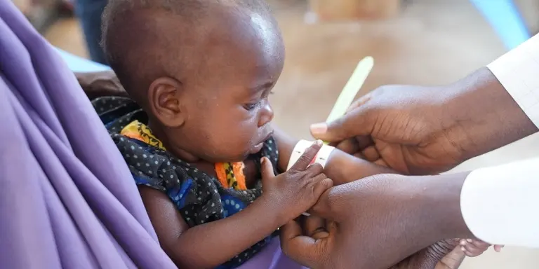 Child malnutrition Somalia