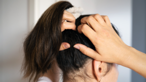 Scalp inflammation relief: how can you stop the itching? Scalp inflammation relief: how can you stop the itching?