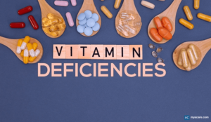 What are vitamin deficiency signs? What are vitamin deficiency signs?