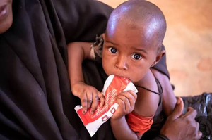 How Child Malnutrition in Somalia Impacts Lives and Communities How Child Malnutrition in Somalia Impacts Lives and Communities