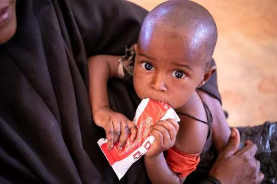 How Child Malnutrition in Somalia Impacts Lives and Communities