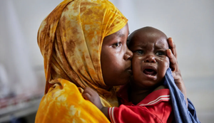 Why is severe child malnutrition ruining lives in Somalia